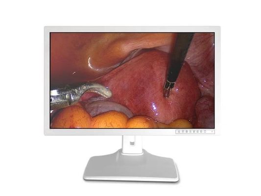 Os acessórios endoscópicos médicos indicam 32inch
