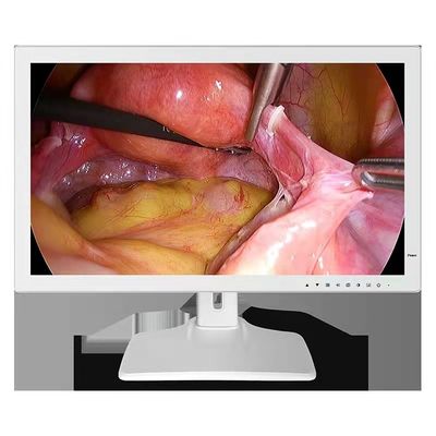 monitor médico 24inch do endoscópio de 1980x1200 RGBS
