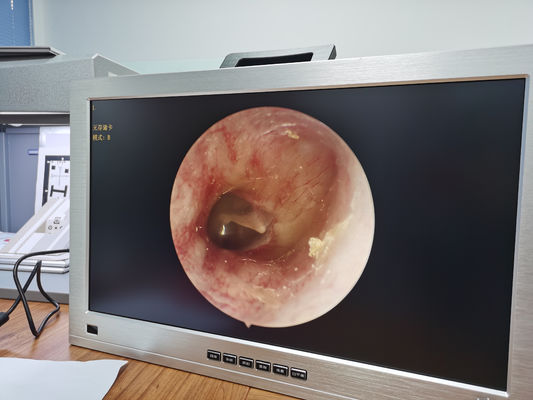 HD completo 1080P 4 em 1 um integrou o sistema médico portátil da câmera do endoscópio