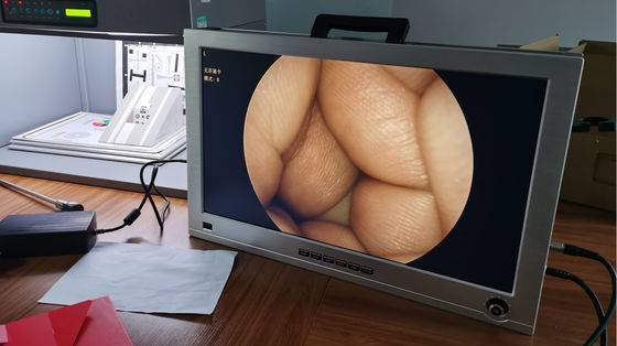 HD completo 1080P 4 em 1 um integrou o sistema médico portátil da câmera do endoscópio